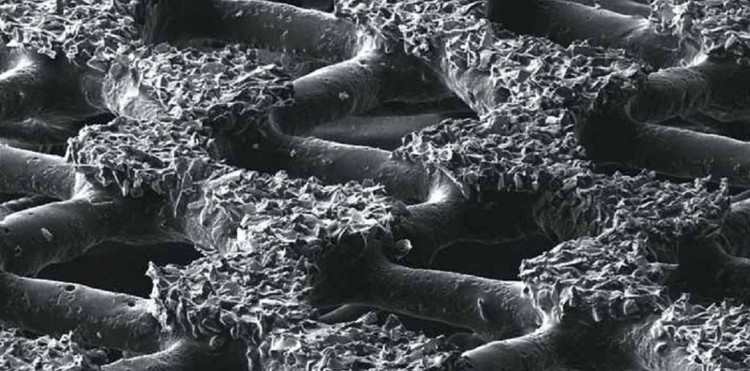 abranet-closeup-d abranet-closeup-d